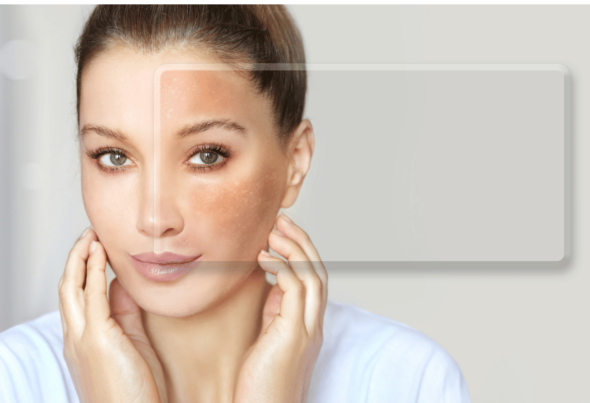 A Women achieve smoother skin by improving her skin’s natural barrier