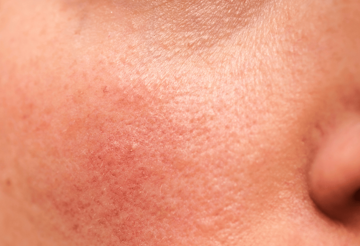 A close-up of combination skin texture, showing a mix of oily and dry areas around the cheek and nose.