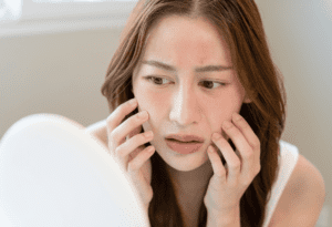 Natural Remedies for Sensitive Skin Care