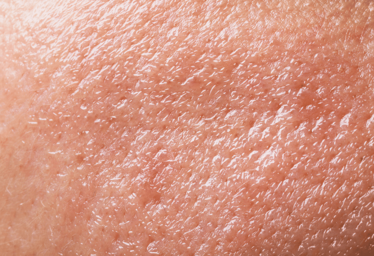 A close-up of oily skin texture, showing a shiny surface with enlarged pores.