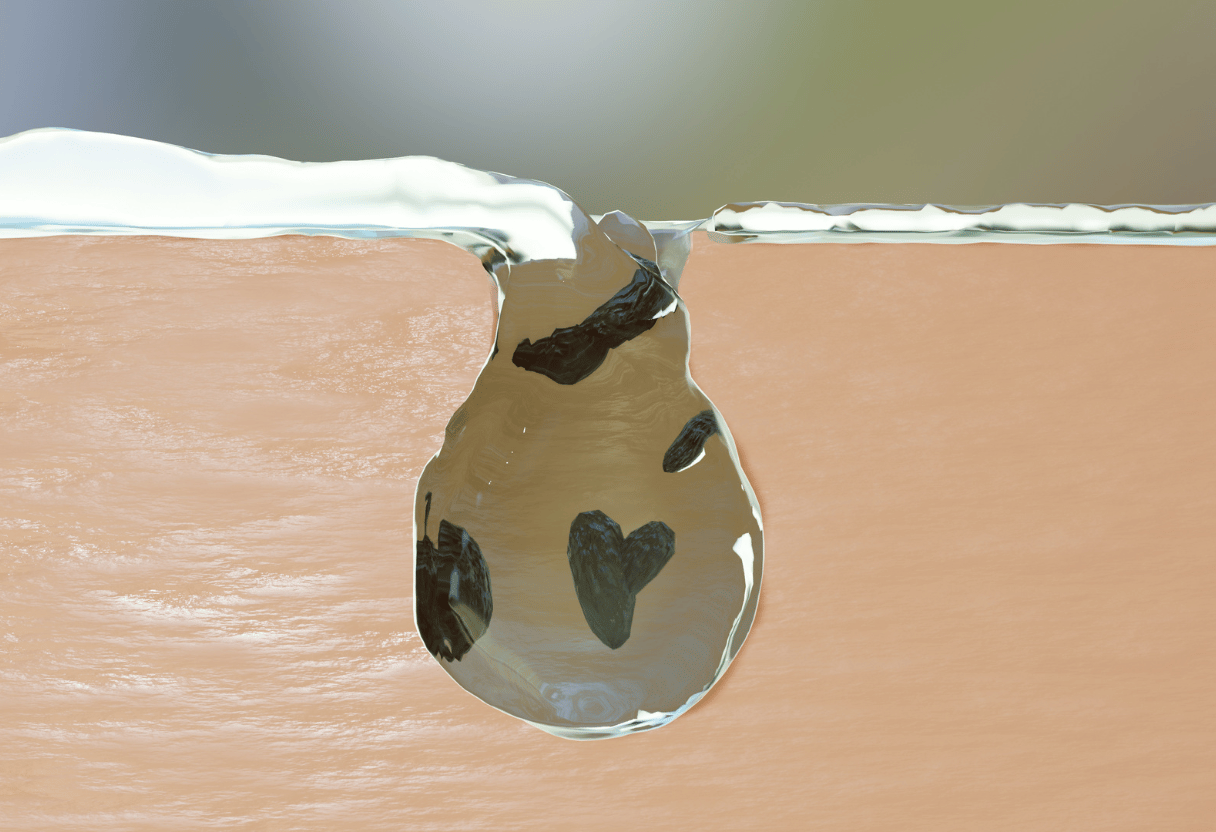 A 3D rendering showcasing the process of deep cleansing with impurities being extracted from a skin pore.